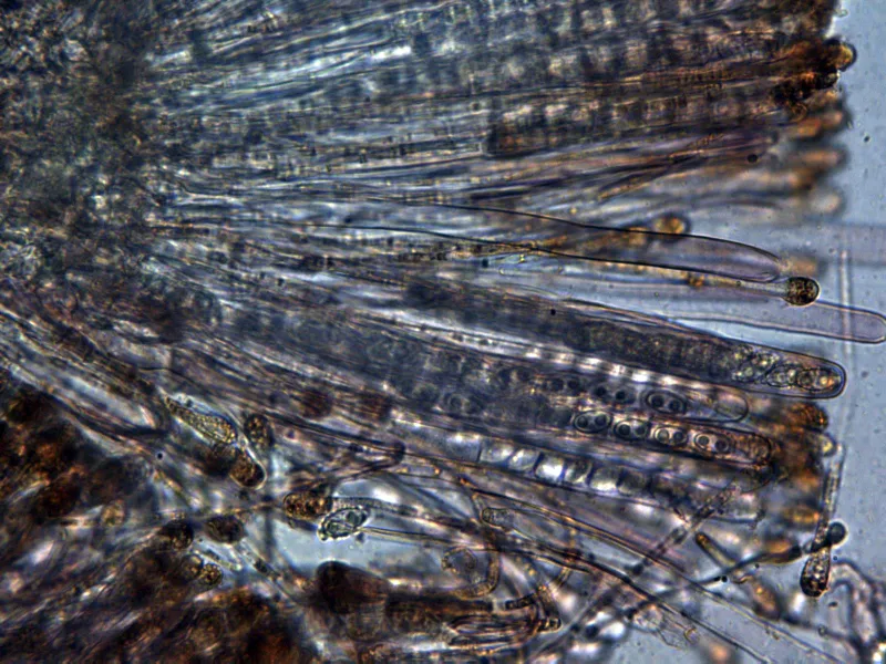 20 - Aleuria aurantia Ascas y paráfisis x 400